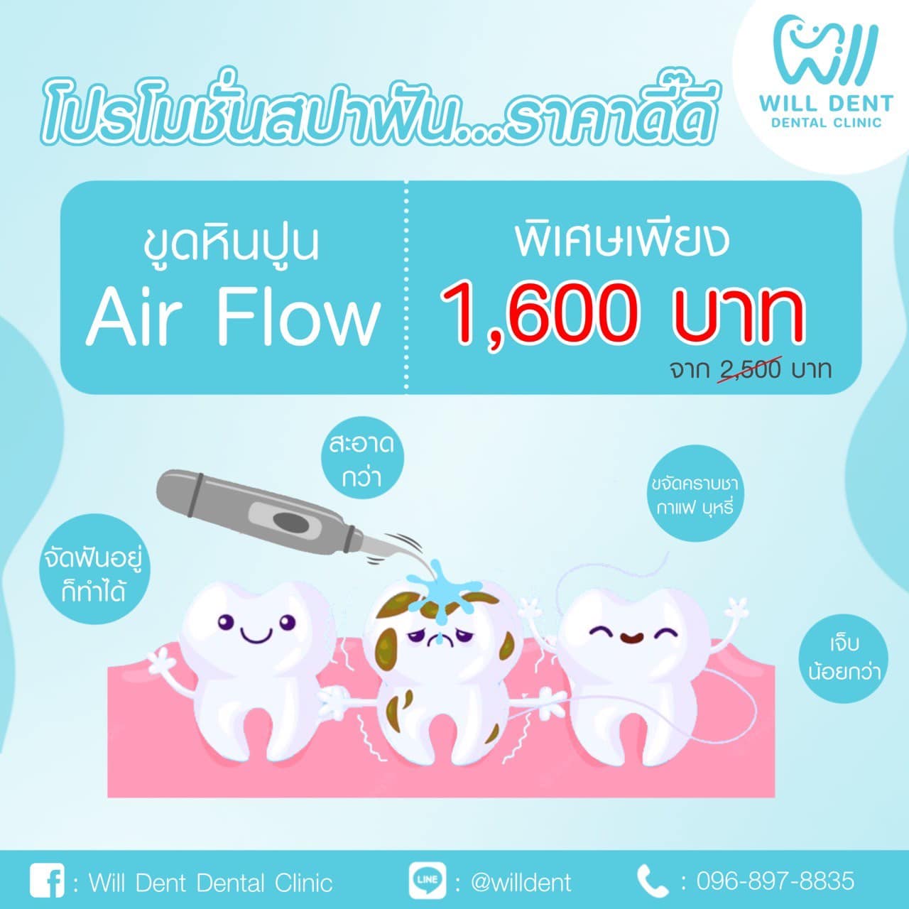 โปรโมชั่นสปาฟัน Air Flow เพียง 1,600 บาทบอกลาความเจ็บกับการขูดหินปูน