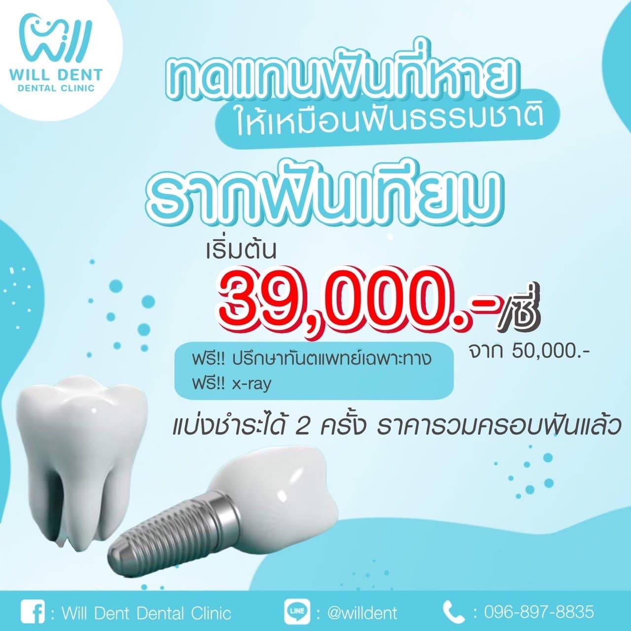 โปรโมชั่นรากฟันเทียมเริ่มต้น 39,000 บาท/ซี่  (จากปกติ 50,000 บาท) ⁣⁣