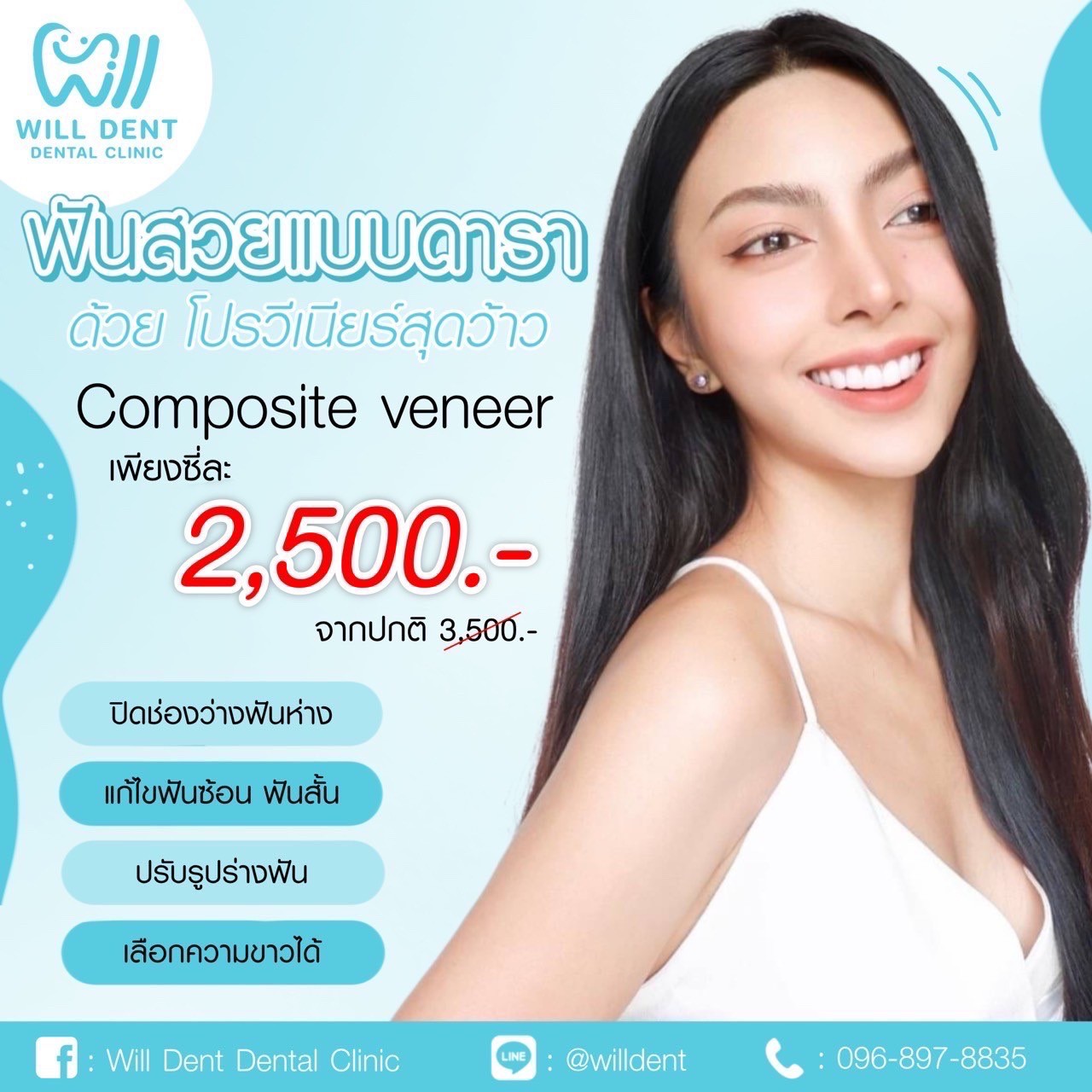 โปรโมชั่น อยากมีฟันสวยแบบดารา ราคาพิเศษสุดปัง Composite Veneer